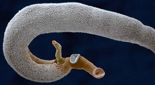 which parasites can live in the human stomach